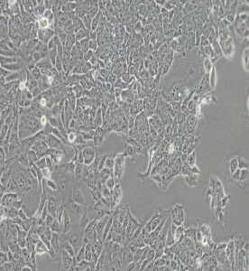 HCT-15人結(jié)直腸腺癌細胞主圖