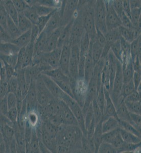 HOS人骨肉瘤細胞主圖