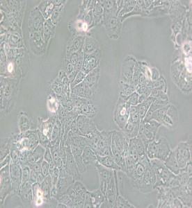 HT-1376人膀胱癌細胞主圖