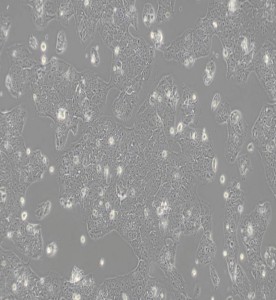 JEG-3人絨毛膜癌細(xì)胞主圖