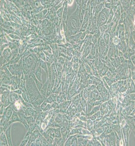 15P-1小鼠睪丸上皮細胞主圖