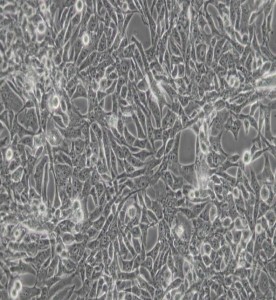 RD人惡性胚胎橫紋肌瘤細胞主圖