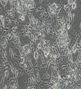 SK-N-BE(2)人神經(jīng)母細(xì)胞瘤細(xì)胞主圖