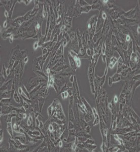 SK-N-SH人神經母細胞瘤細胞主圖