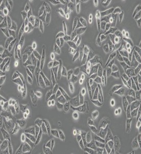 SK-OV-3人卵巢癌細(xì)胞主圖