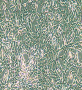 SUM159PT人乳腺癌細(xì)胞主圖