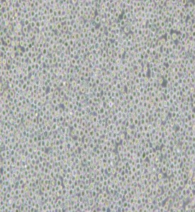 MV-4-11人髓性單核細(xì)胞白血病細(xì)胞主圖