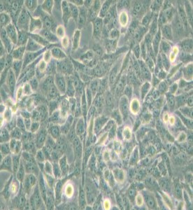 NCI-H157人非小細(xì)胞肺腺癌細(xì)胞主圖
