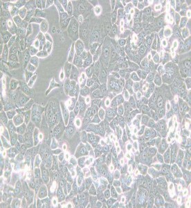 NCI-H2126人肺癌細(xì)胞主圖
