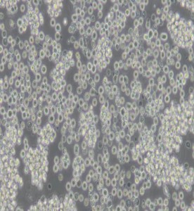 Raji人Burkitt's淋巴瘤細胞主圖