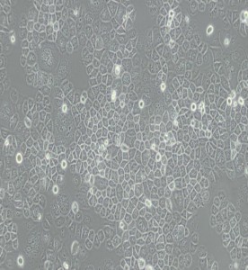 SW-13人腎上腺皮質(zhì)小細胞癌細胞(L15)主圖