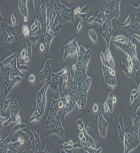 SW620人結腸癌細胞(L15)主圖