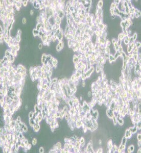 WERI-Rb-1人視網膜神經膠質瘤細胞主圖