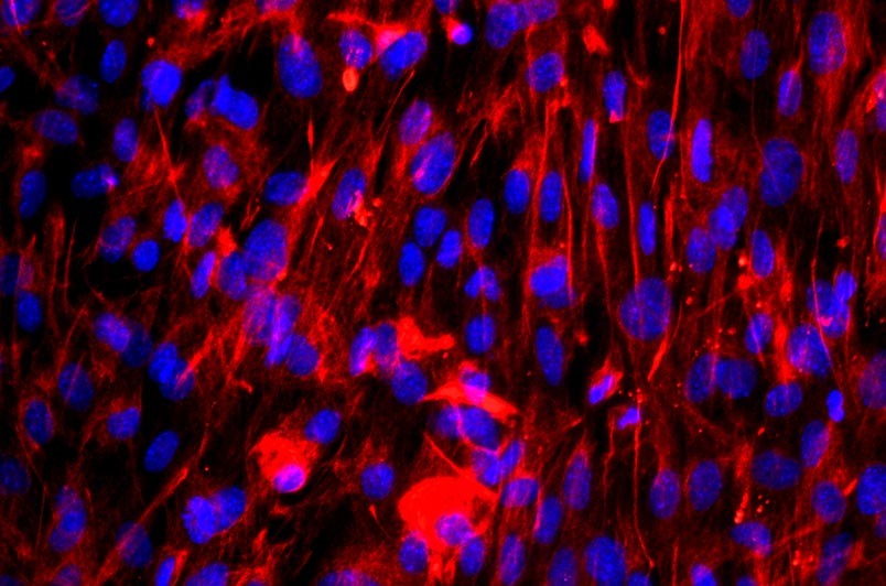 小鼠肺成纖維細胞主圖