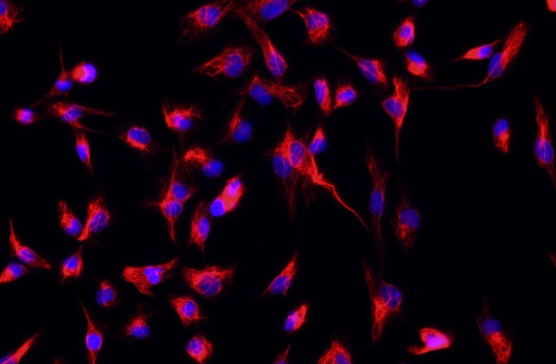 小鼠腎成纖維細(xì)胞主圖