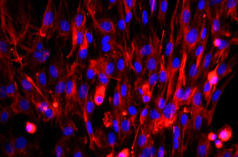 小鼠胚胎成纖維細胞主圖
