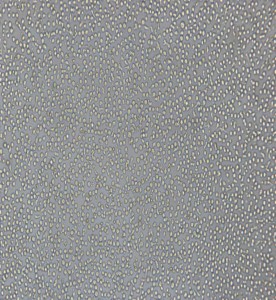 CoC1人卵巢癌細胞主圖