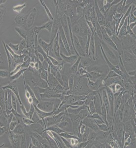 HUV-EC-C[HUVEC]人臍靜脈血管內(nèi)皮細(xì)胞主圖