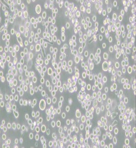 MEG-01人成巨核細胞白血病細胞主圖