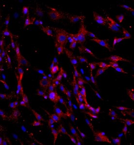 人骨髓間充質(zhì)干細胞主圖