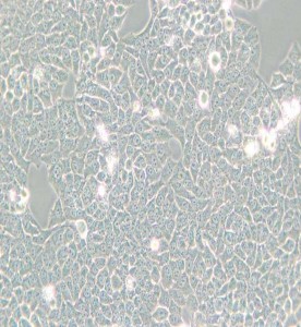 Hela-229人宮頸癌細胞主圖