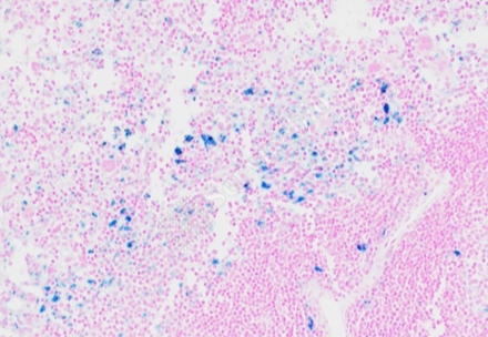 普魯士藍(lán)染色（含鐵血黃素）主圖