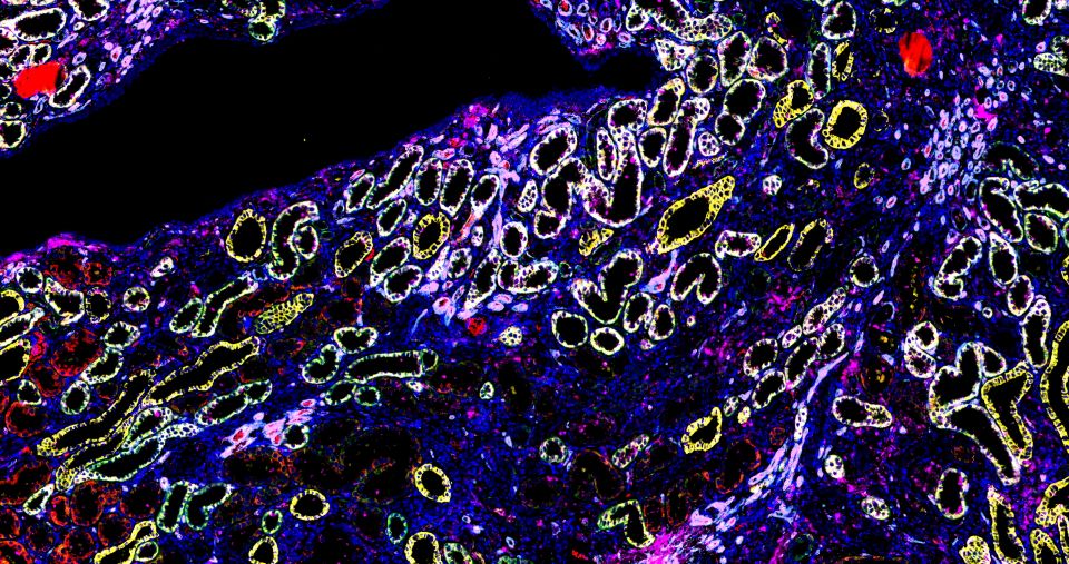 免疫熒光五標六色染色主圖