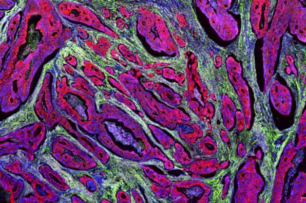 免疫熒光四標五色染色主圖